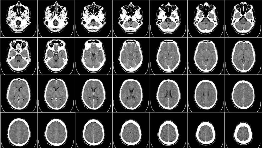 DICOM-Medical-Images-from-a-CD-on-99insight